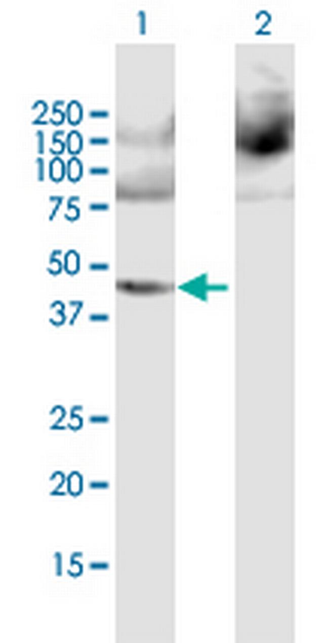 PPME1 Antibody in Western Blot (WB)