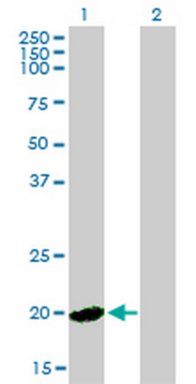 HPCAL4 Antibody in Western Blot (WB)