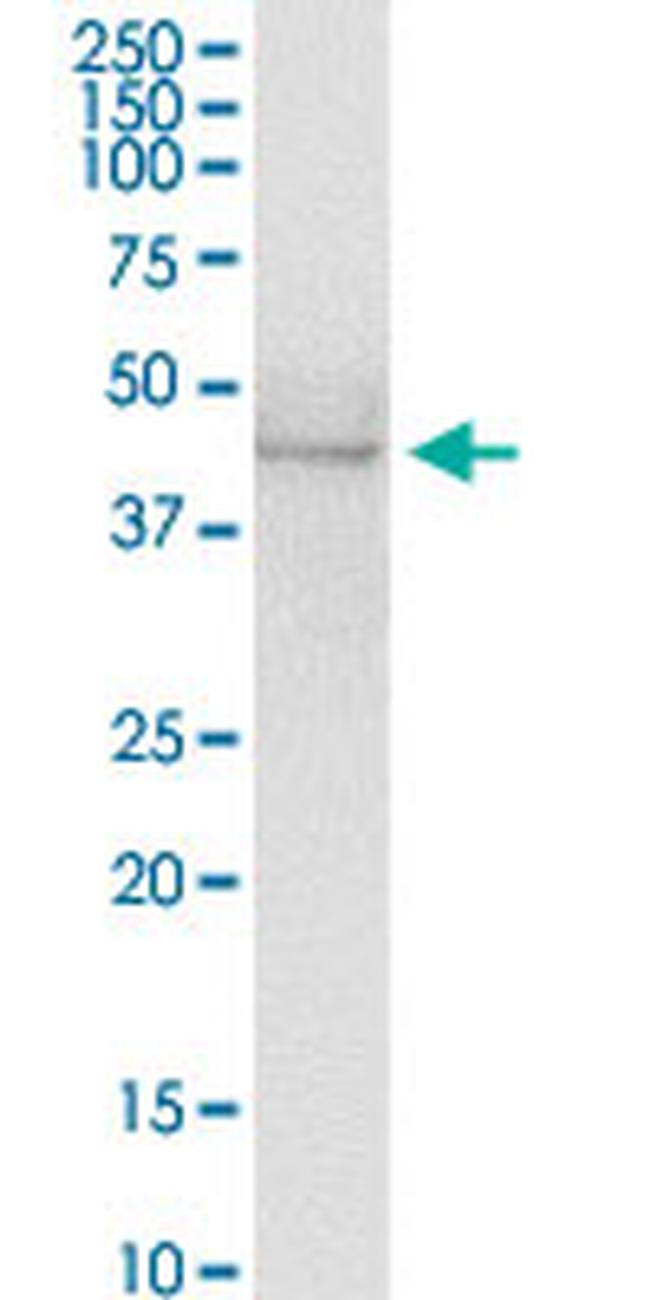 AZIN1 Antibody in Western Blot (WB)