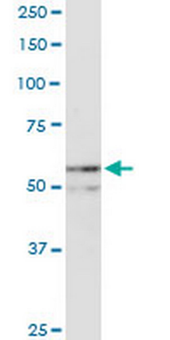NUP54 Antibody in Western Blot (WB)