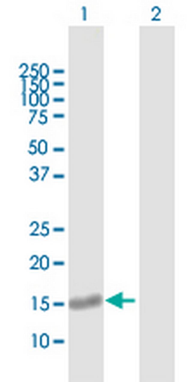 PLEKHJ1 Antibody in Western Blot (WB)