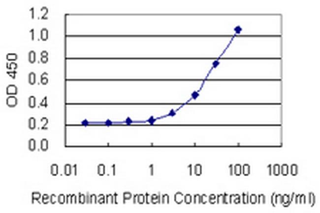 TRIM62 Antibody in ELISA (ELISA)