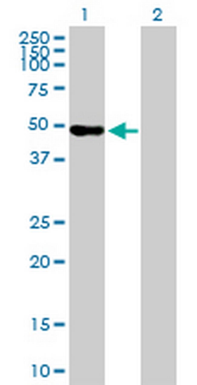 WDR41 Antibody in Western Blot (WB)