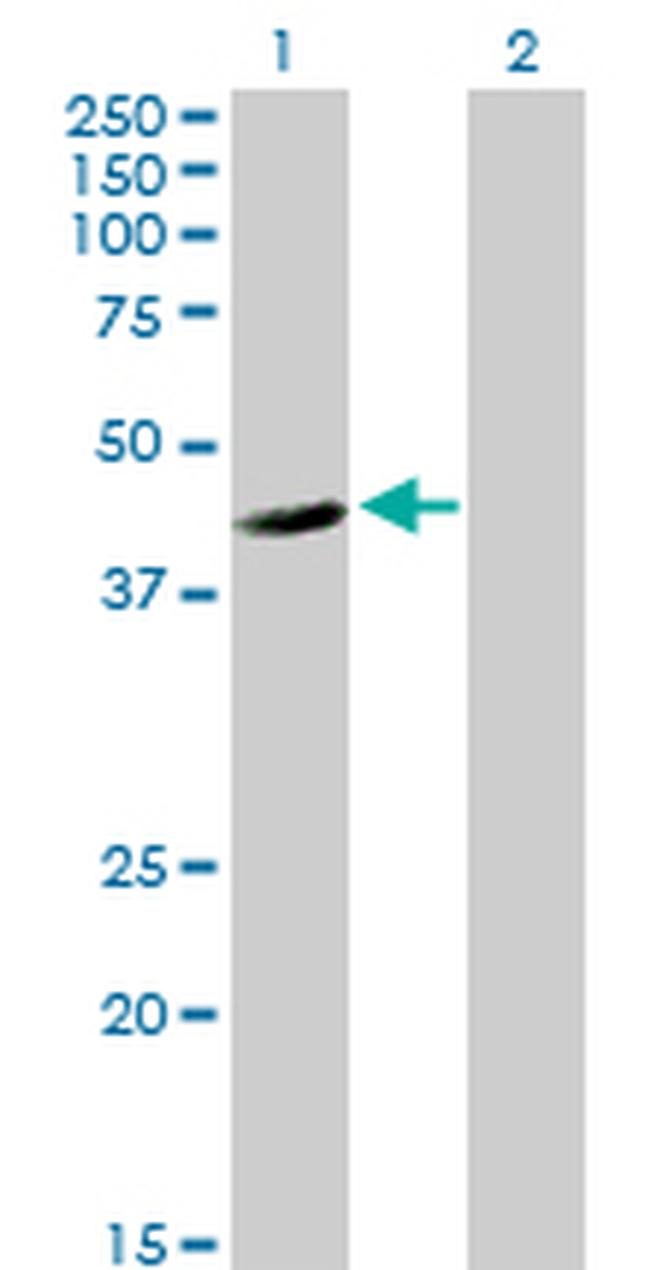 FLJ10986 Antibody in Western Blot (WB)