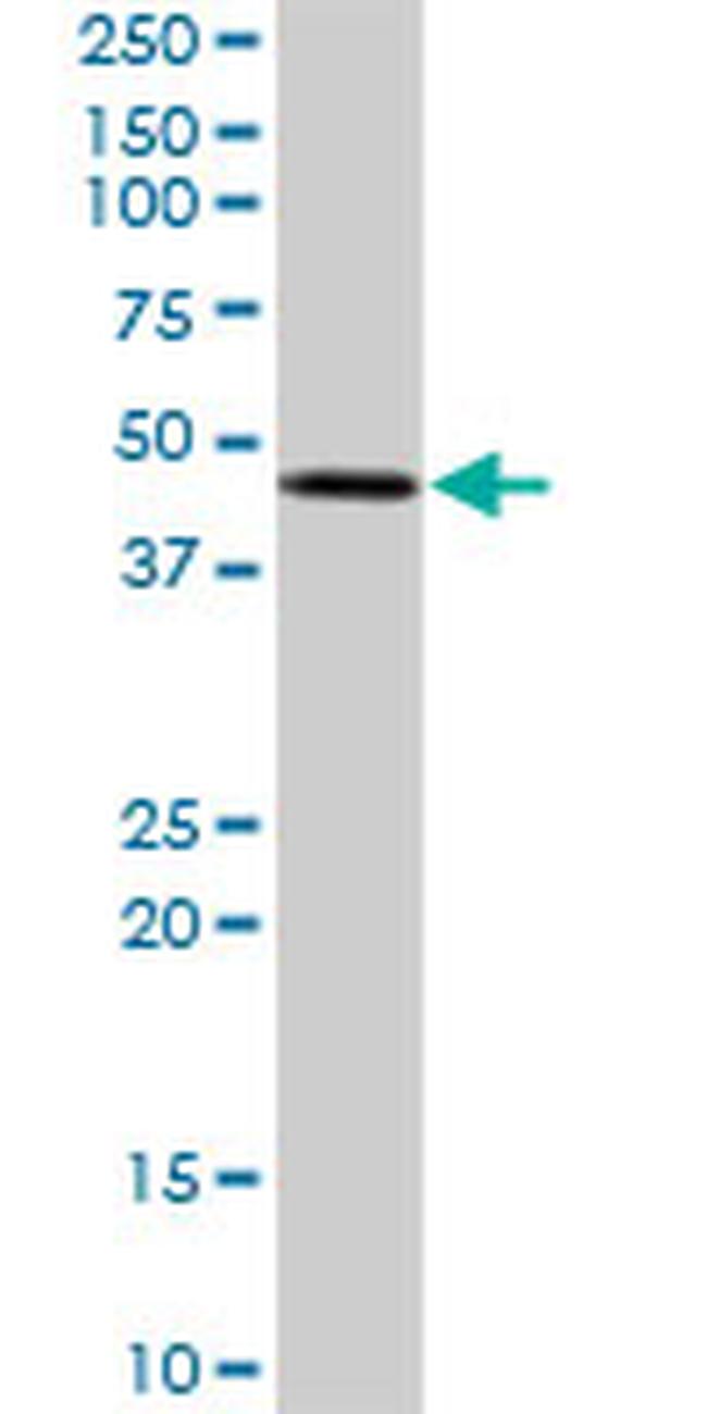 STYK1 Antibody in Western Blot (WB)