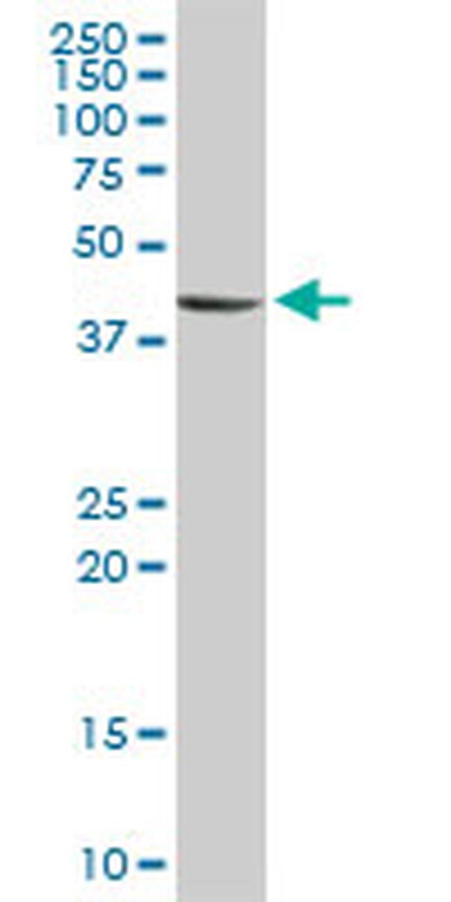 STYK1 Antibody in Western Blot (WB)