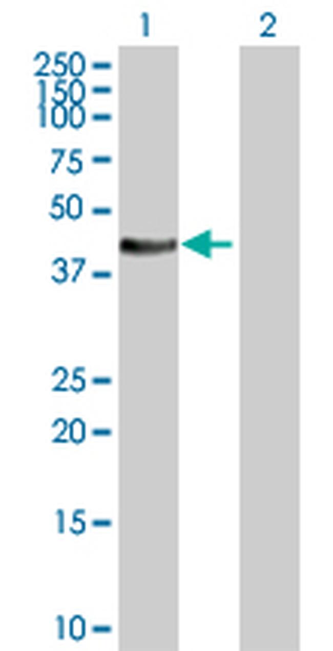 STYK1 Antibody in Western Blot (WB)