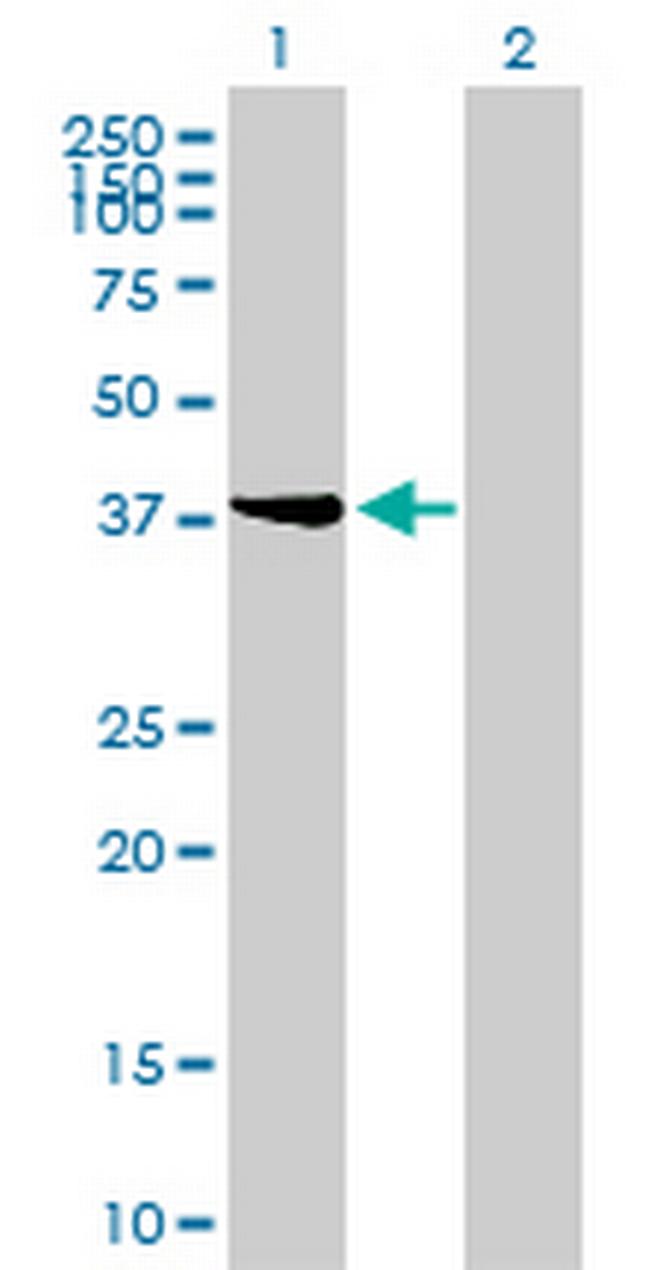 STYK1 Antibody in Western Blot (WB)