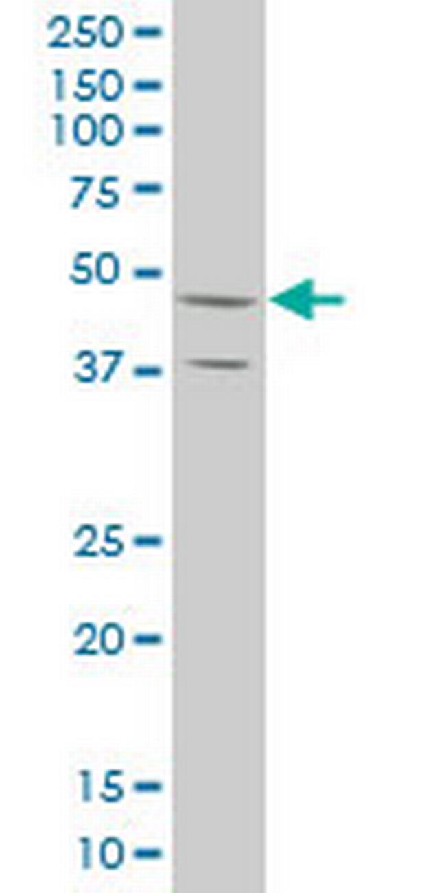 STYK1 Antibody in Western Blot (WB)