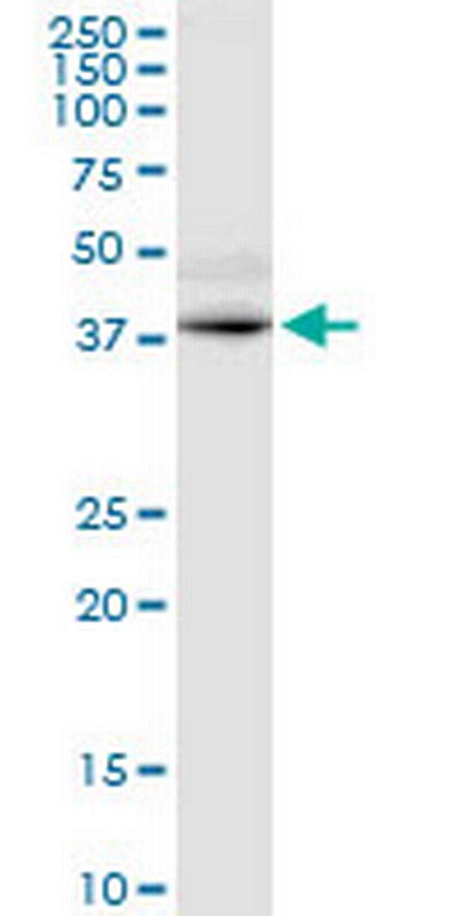 GPRC5D Antibody in Western Blot (WB)