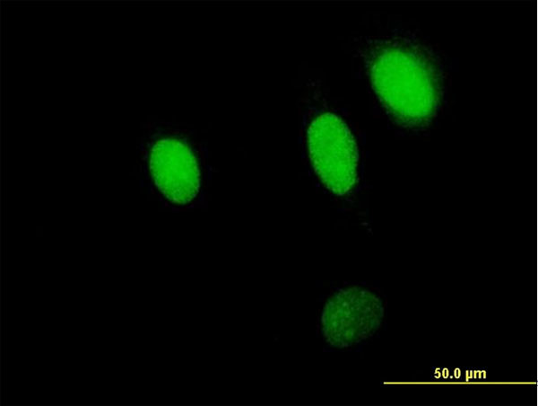 NPLOC4 Antibody in Immunocytochemistry (ICC/IF)