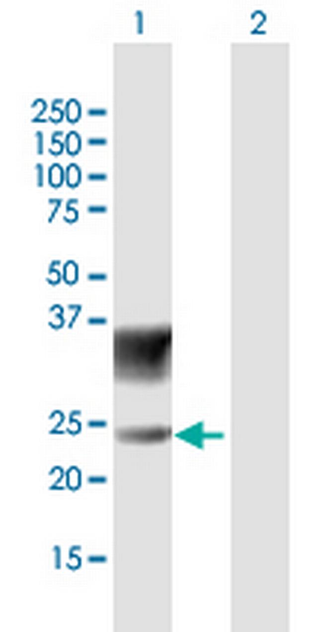 SCN3B Antibody in Western Blot (WB)