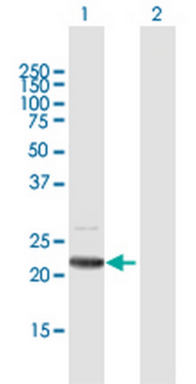 C19orf80 Antibody in Western Blot (WB)