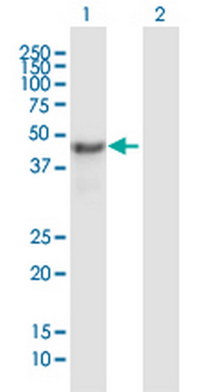 NSFL1C Antibody in Western Blot (WB)