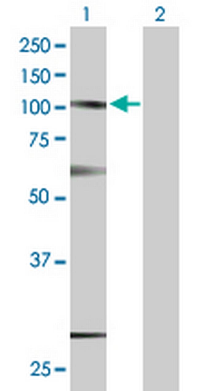 SUSD2 Antibody in Western Blot (WB)