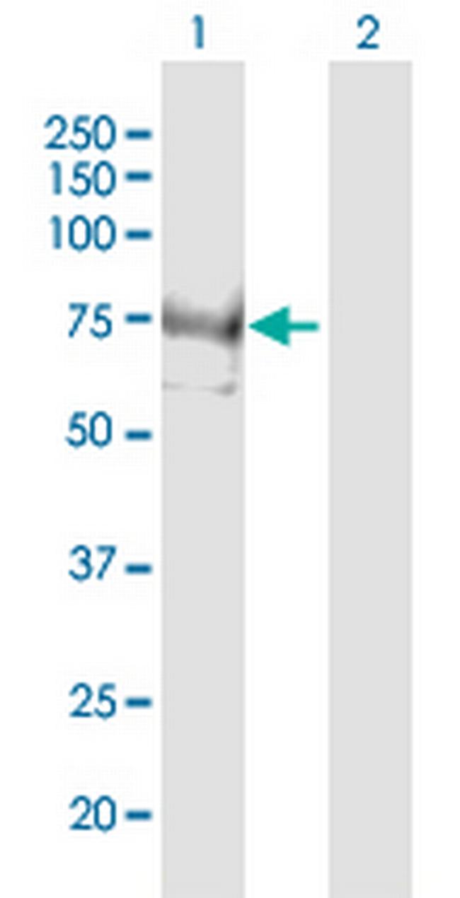 INPP5E Antibody in Western Blot (WB)