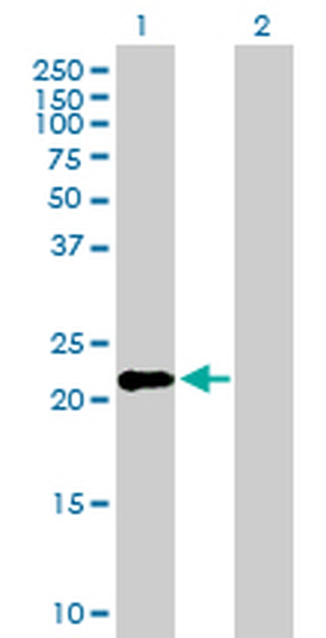 IFNK Antibody in Western Blot (WB)