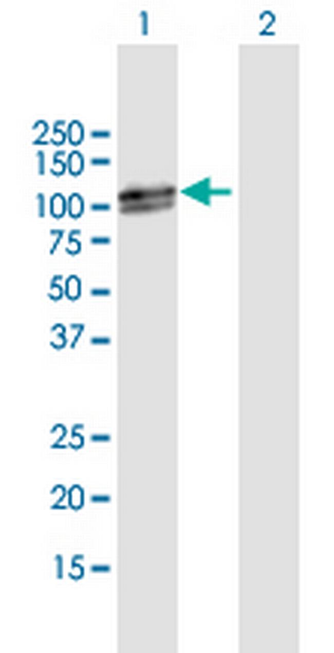 RAD18 Antibody in Western Blot (WB)