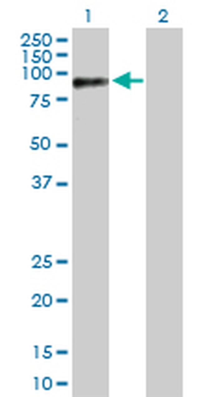 RAD18 Antibody in Western Blot (WB)