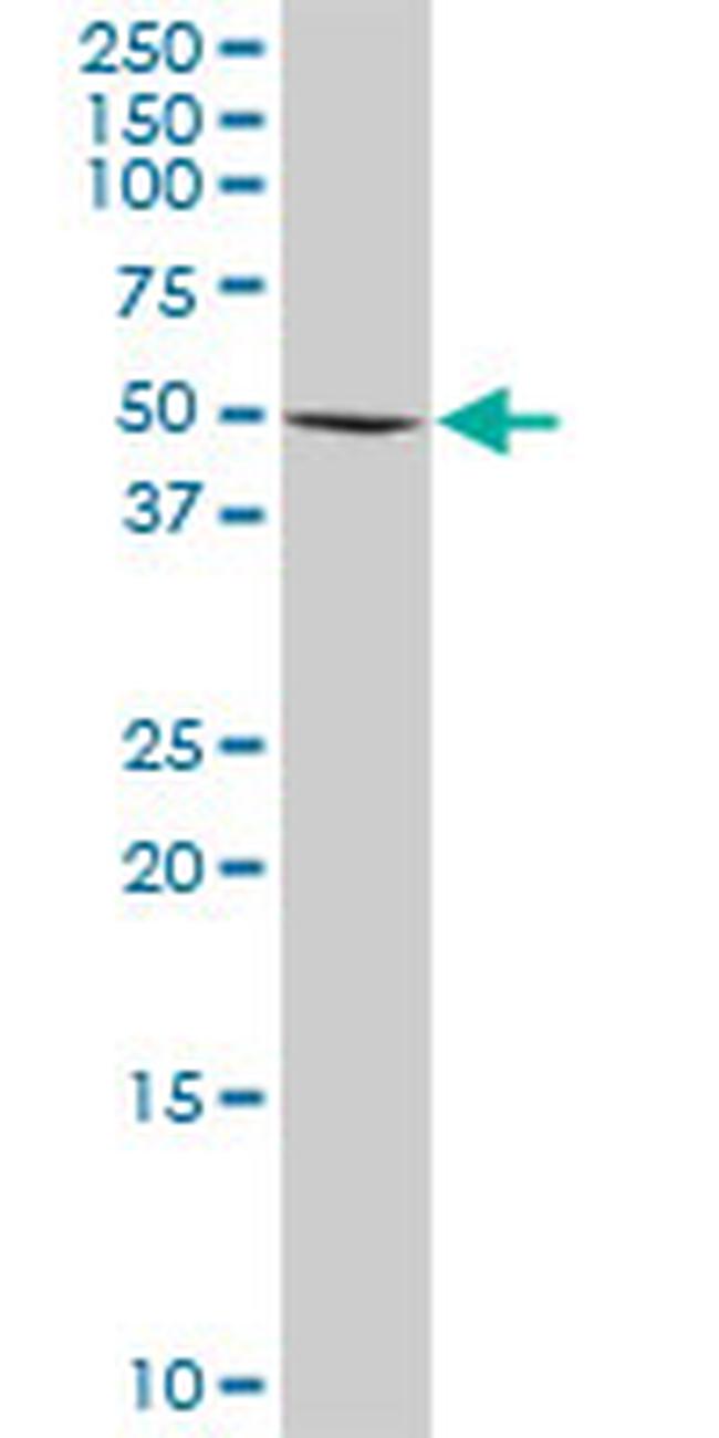 RAD18 Antibody in Western Blot (WB)