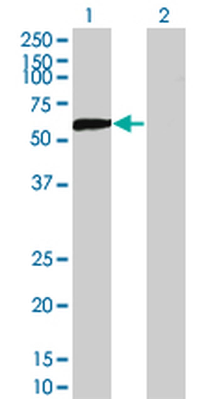 DPYSL5 Antibody in Western Blot (WB)