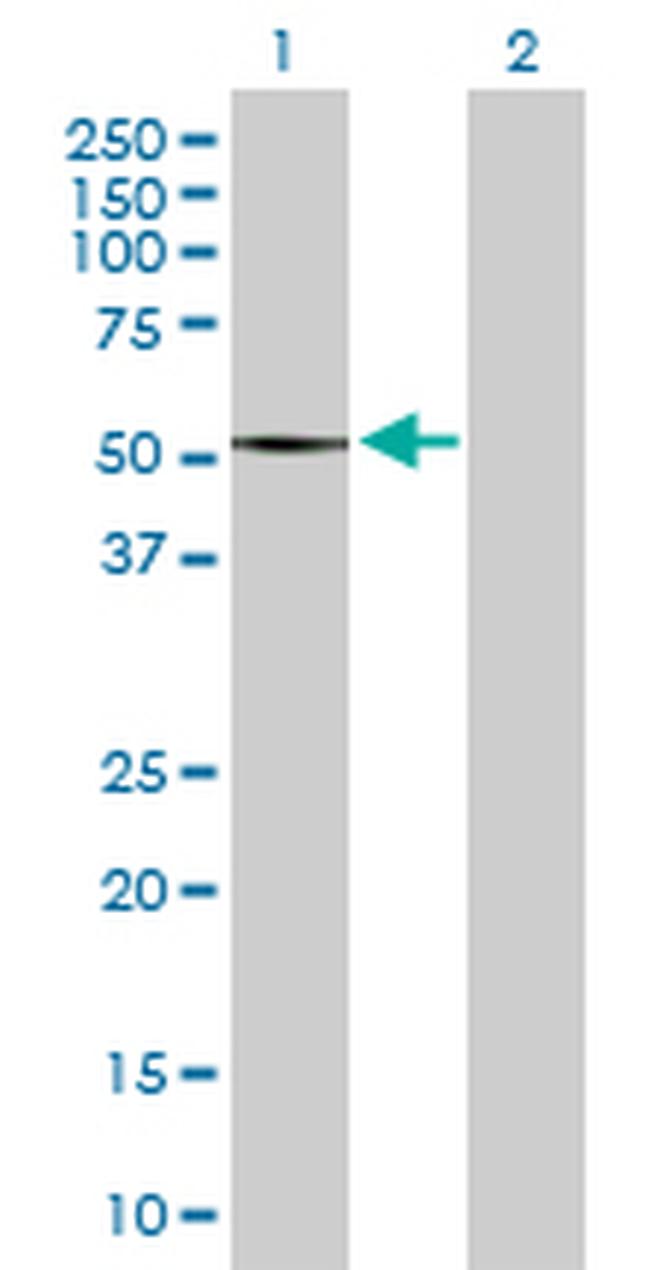 SMYD2 Antibody in Western Blot (WB)