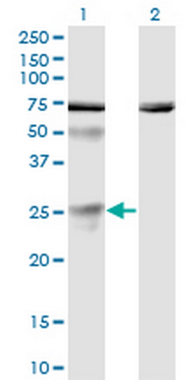 TWSG1 Antibody in Western Blot (WB)