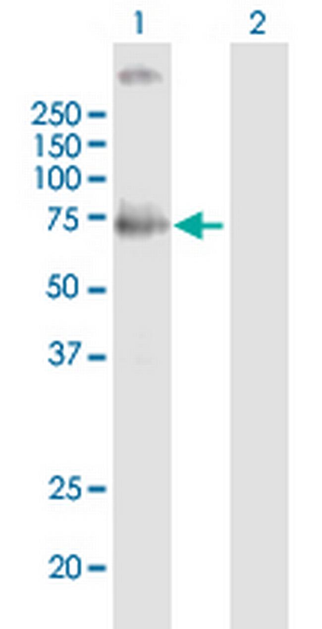 MCOLN1 Antibody in Western Blot (WB)