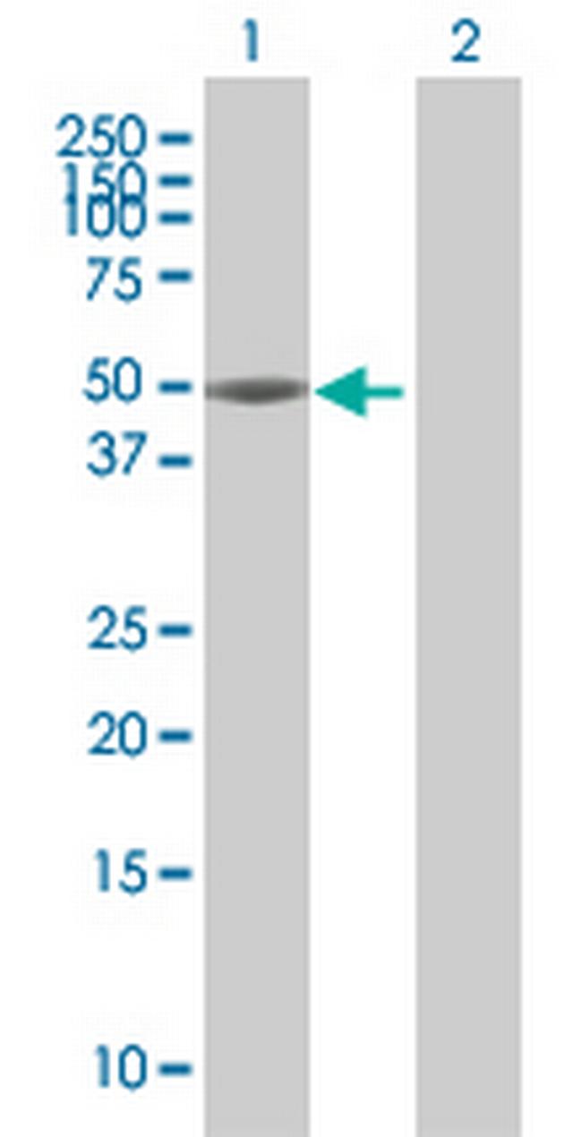 CBX8 Antibody in Western Blot (WB)