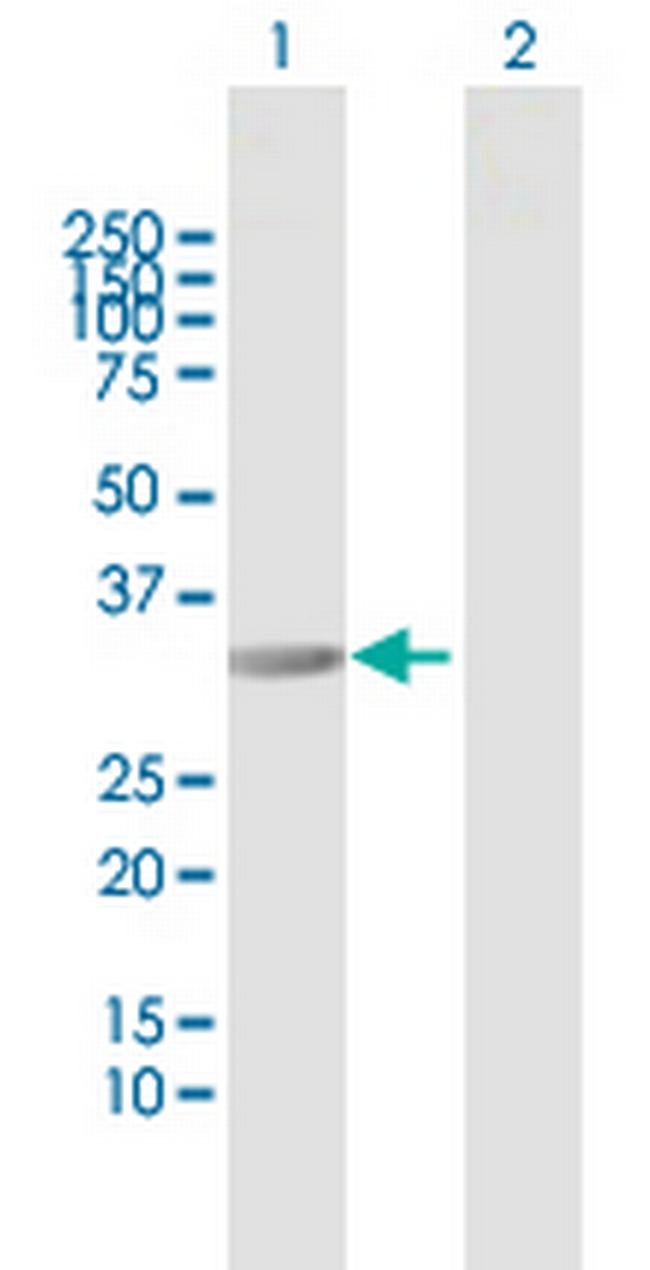 RIMKLB Antibody in Western Blot (WB)