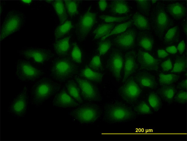 TRIB3 Antibody in Immunocytochemistry (ICC/IF)