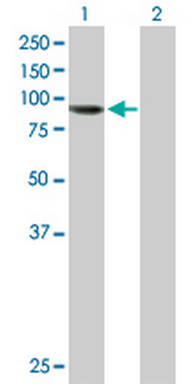 AGBL5 Antibody in Western Blot (WB)