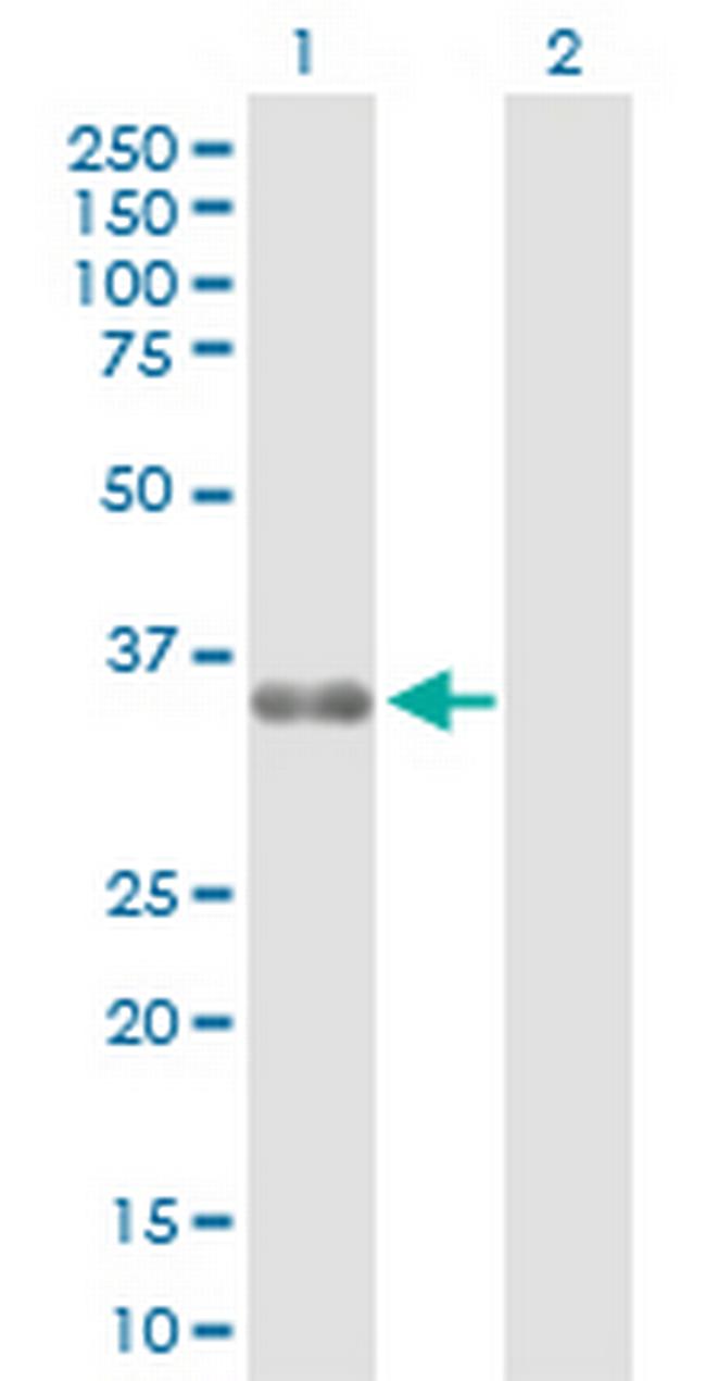 ZMAT3 Antibody in Western Blot (WB)