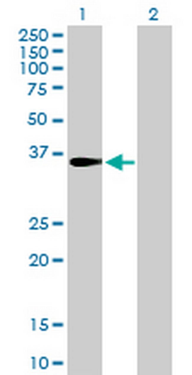 CENPH Antibody in Western Blot (WB)