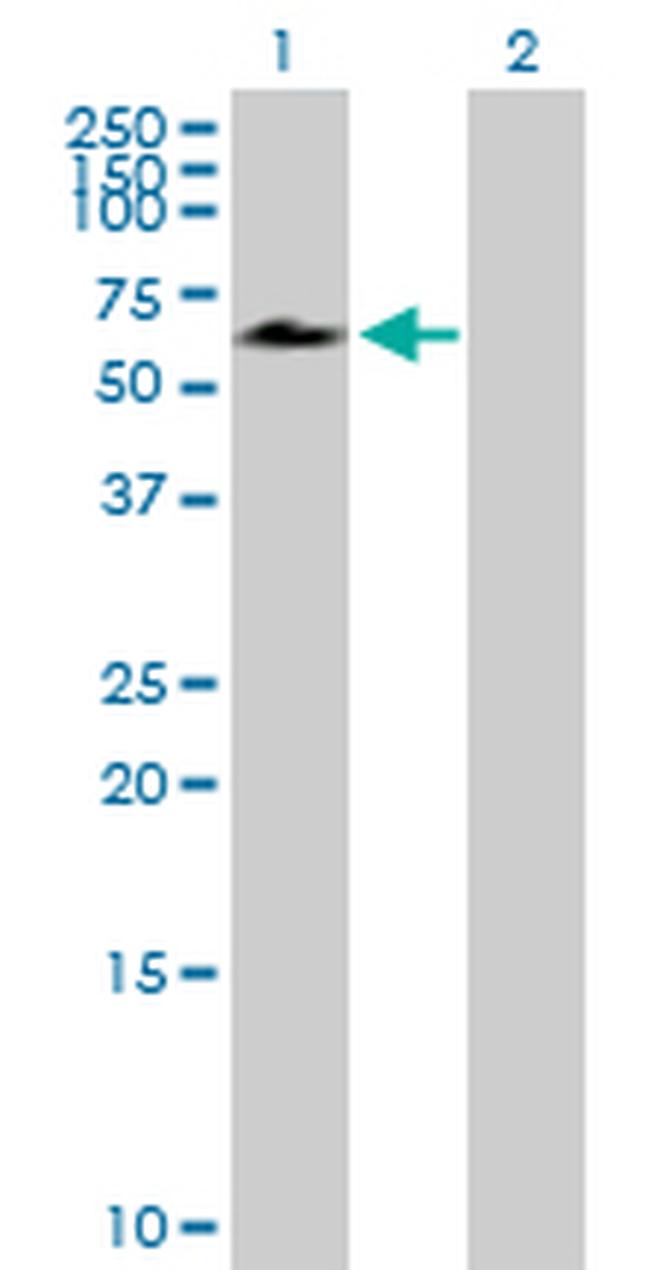 ACD Antibody in Western Blot (WB)