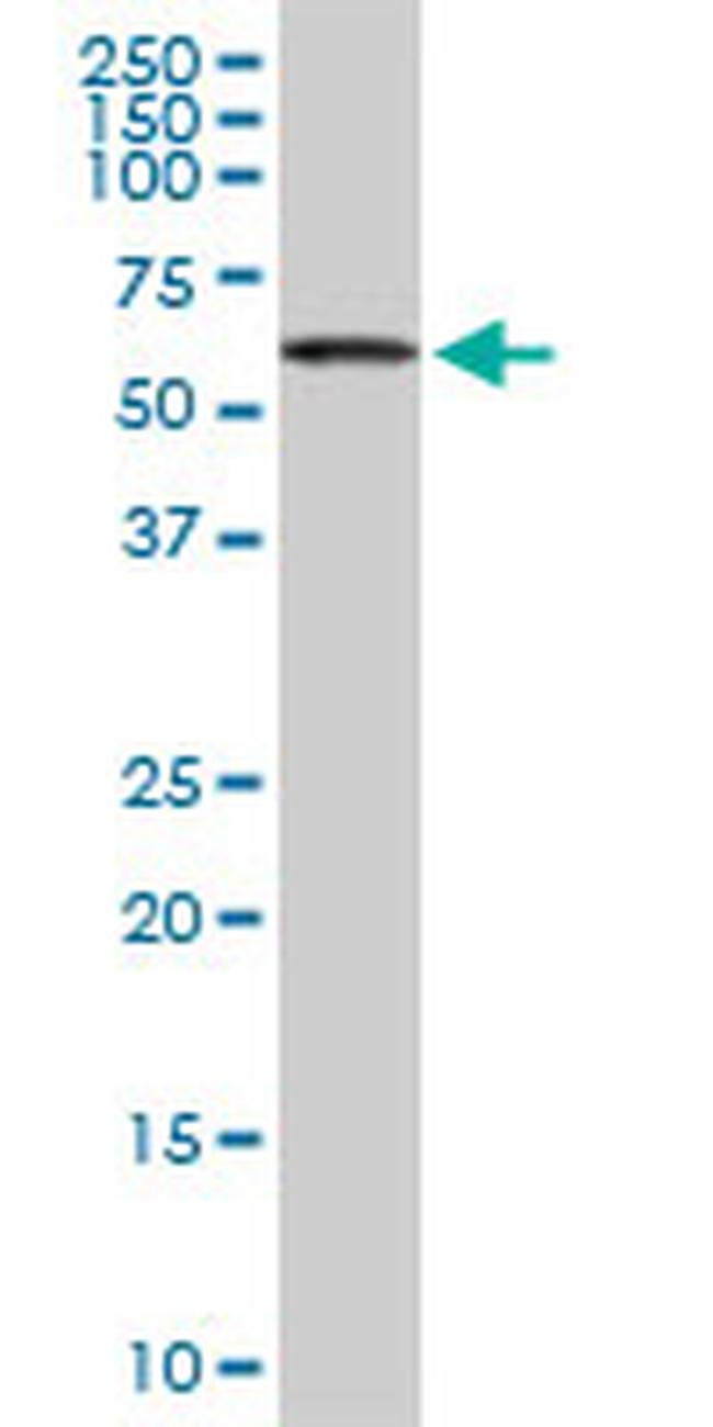 ACD Antibody in Western Blot (WB)