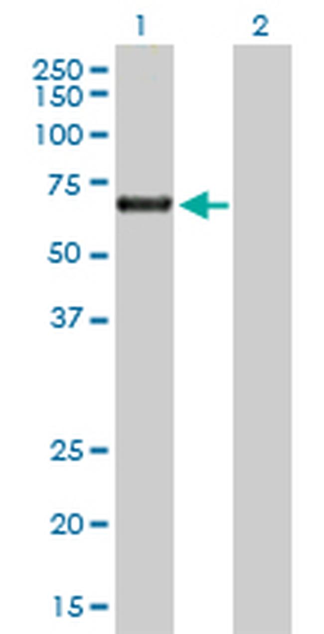 ACD Antibody in Western Blot (WB)