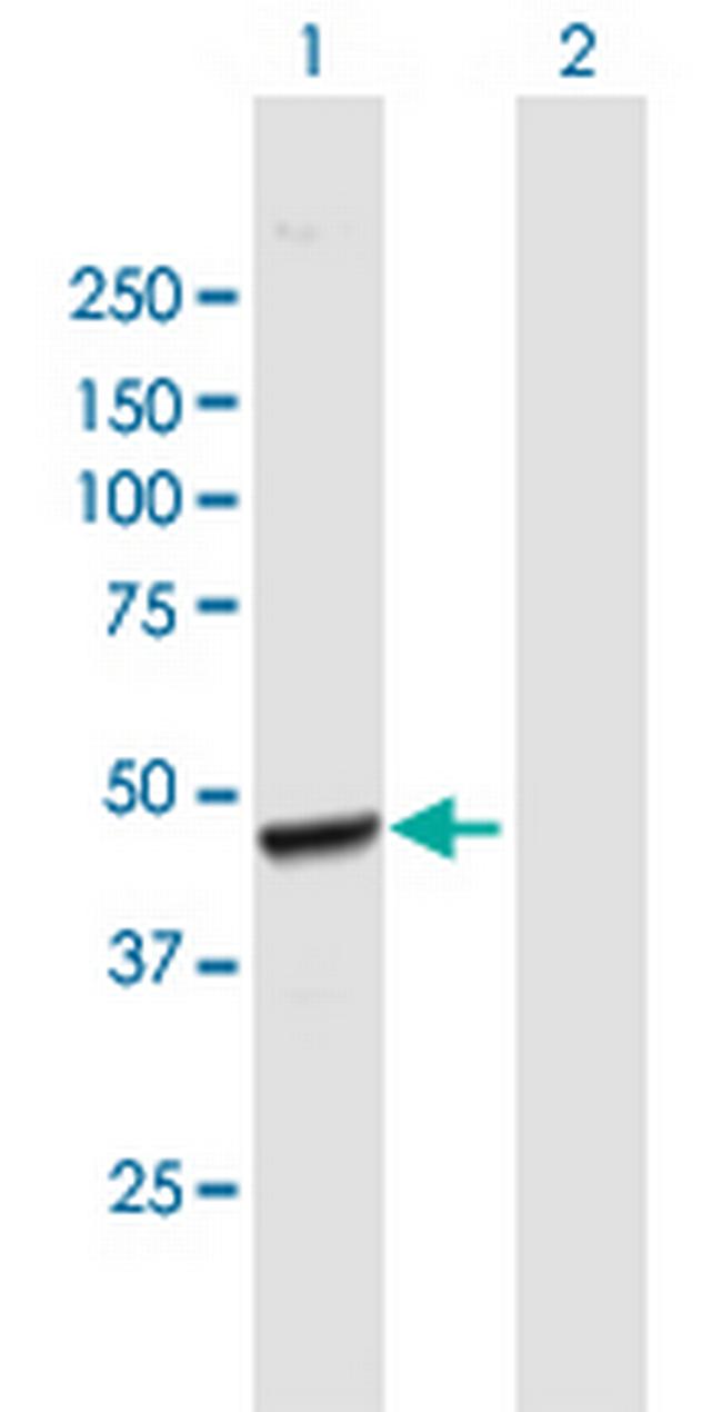 AACS Antibody in Western Blot (WB)