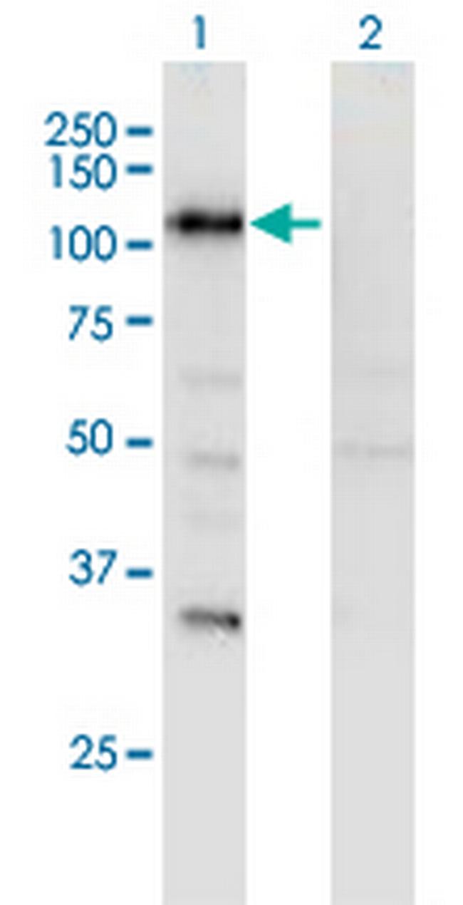 SECISBP2 Antibody in Western Blot (WB)