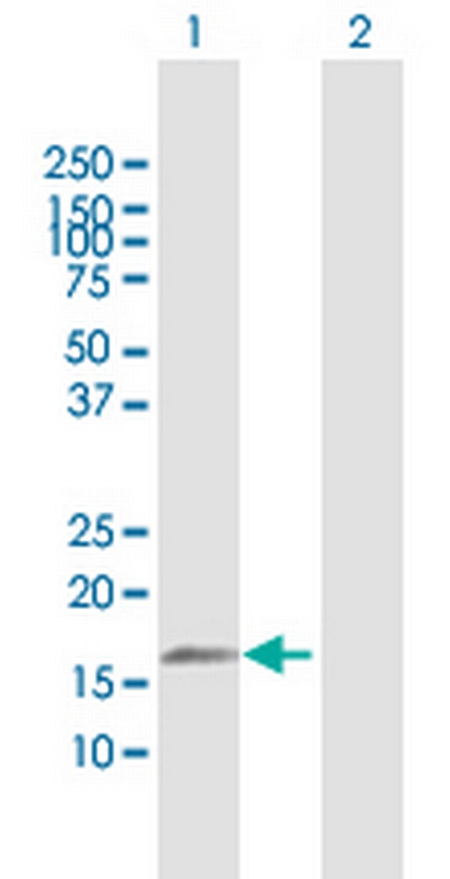 TNFAIP8L2 Antibody in Western Blot (WB)