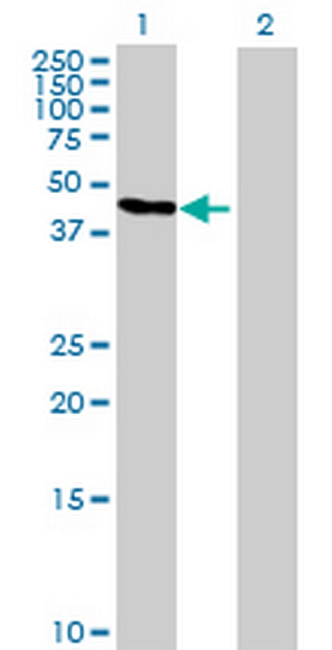 GTDC1 Antibody in Western Blot (WB)