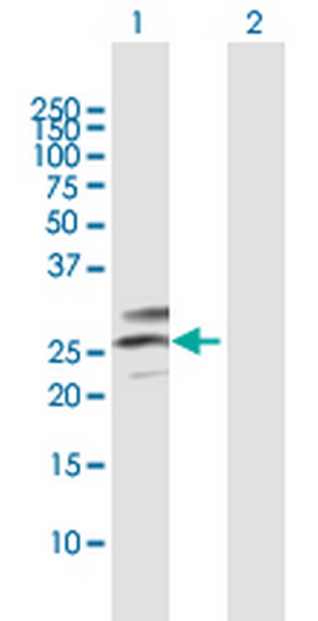 C12orf49 Antibody in Western Blot (WB)