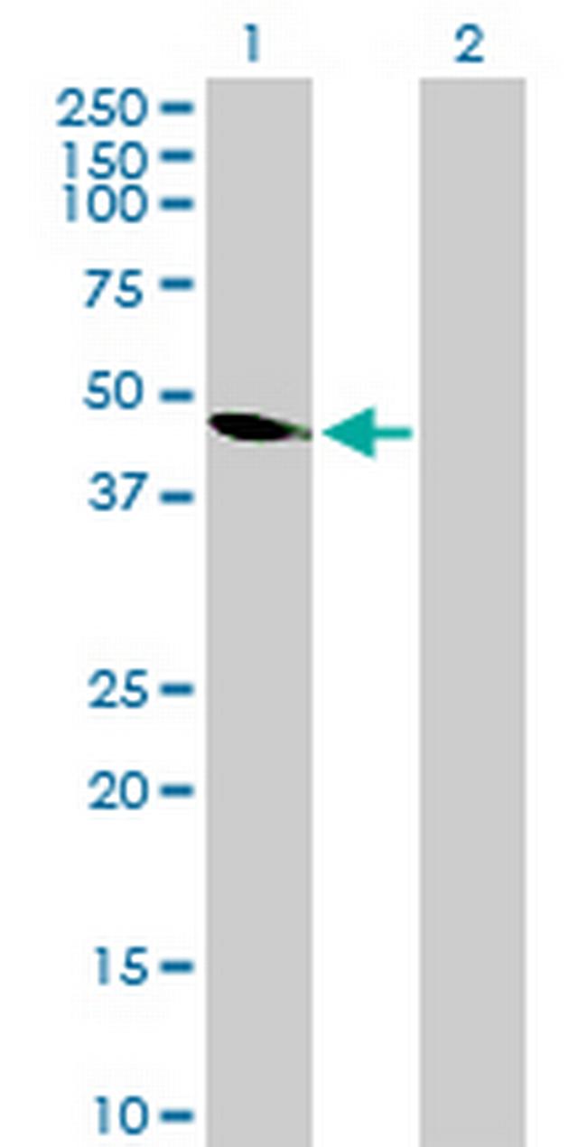 C18orf22 Antibody in Western Blot (WB)