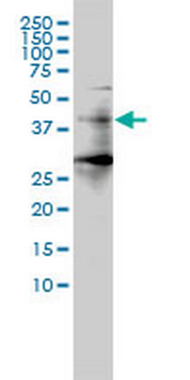 HDAC11 Antibody in Western Blot (WB)