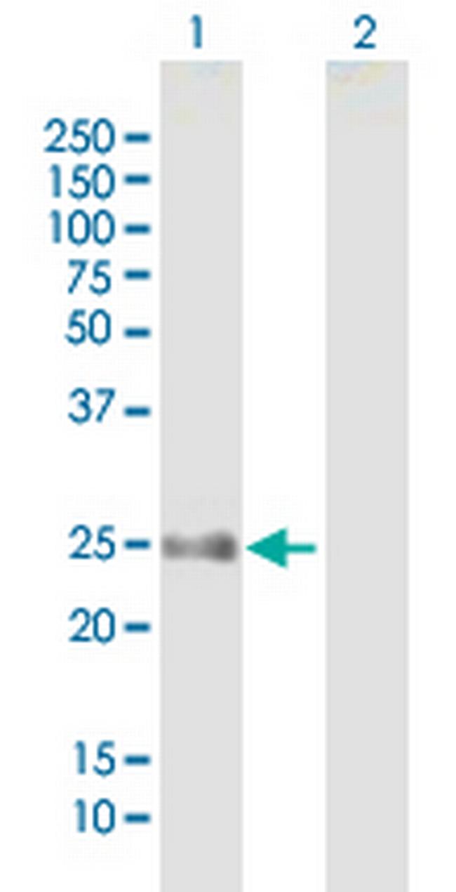 FLJ14154 Antibody in Western Blot (WB)