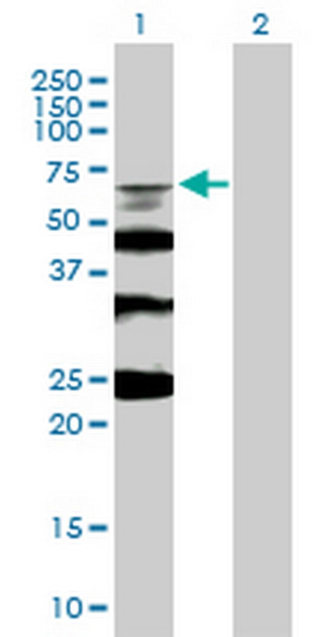 RMI1 Antibody in Western Blot (WB)