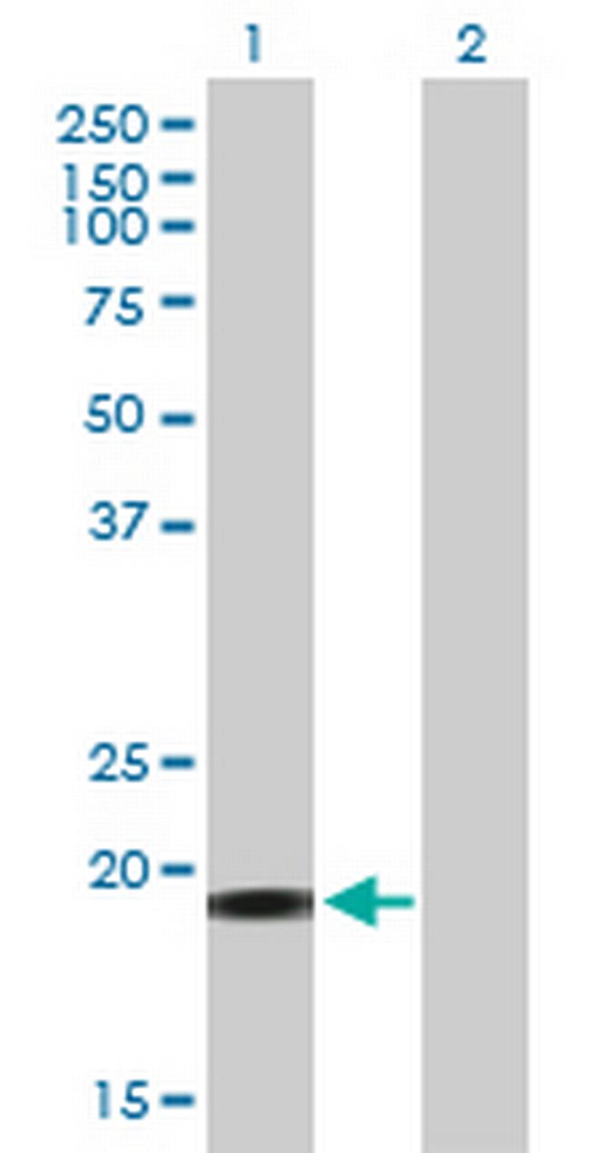 YSK4 Antibody in Western Blot (WB)