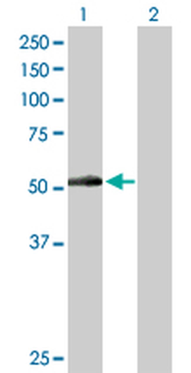 PNPLA3 Antibody in Western Blot (WB)