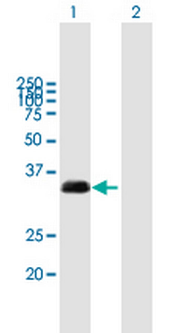 TXNDC1 Antibody in Western Blot (WB)