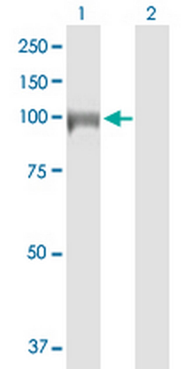 DIAPH3 Antibody in Western Blot (WB)